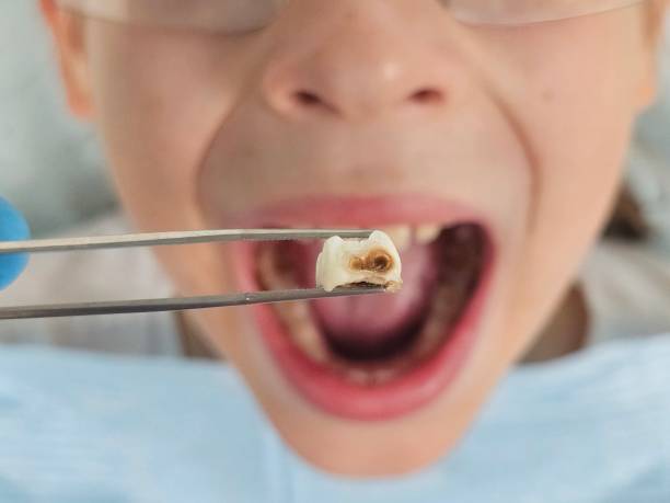 Best Emergency Gum Pain Relief  in Cambridge, OH